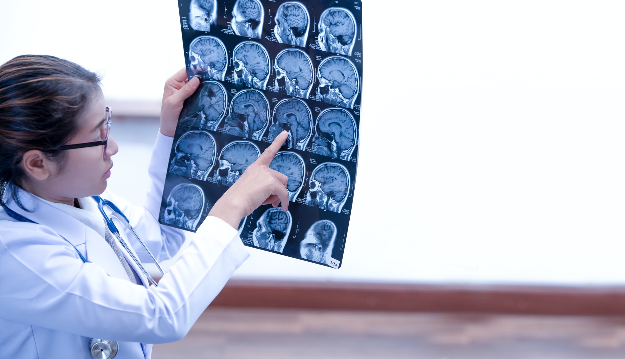 doctor holding index finger to MRI scan