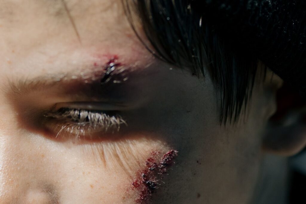 Injuries Involving Children