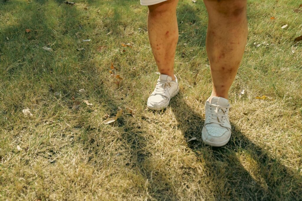 Injuries Involving Children